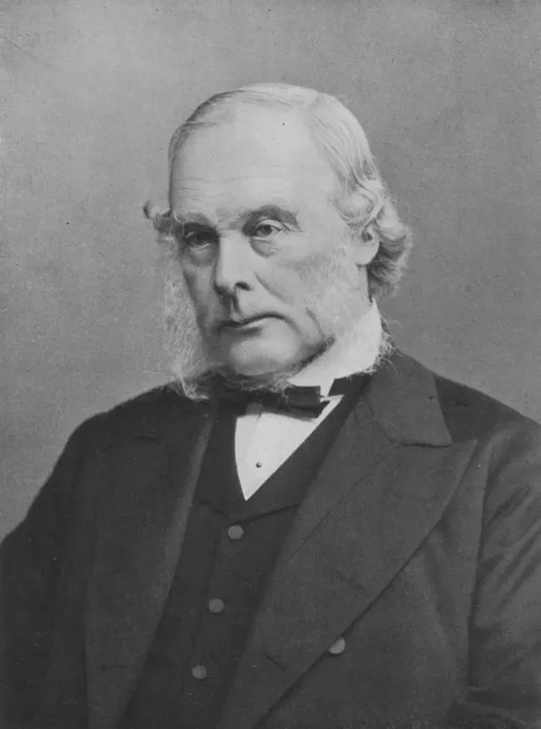 Joseph Lister, pioneer of surgery and antiseptic at the University of Glasgow and Glasgow and Edinburgh Royal, died